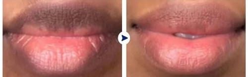Customer photo review of Pink Lip Kit