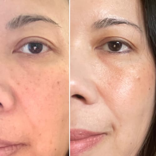 Customer photo review of Fau Skin Solution BB Cream