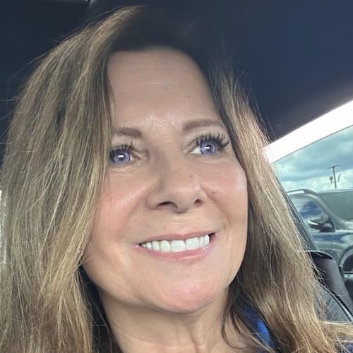 Customer photo review of Bellini Brown Prescription Colored Contact Lenses