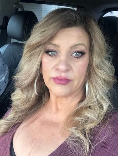 Customer photo review of New! Radiant Glow Pads (Acid Wipes) For Radiant Skin ππΏππΏ