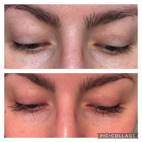 Customer photo review of LASH GROWTH SERUM