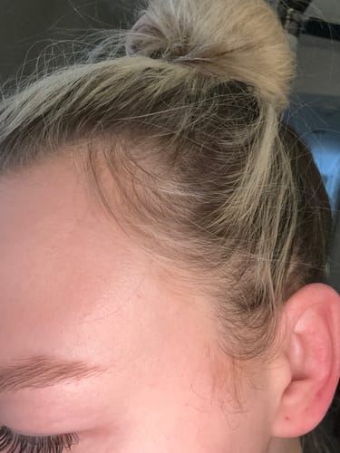 Customer photo review of Pre-Wash Scalp Oil by TR