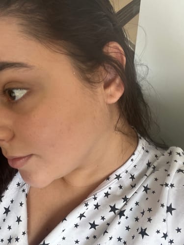 Customer photo review of Solução Retinol-Like