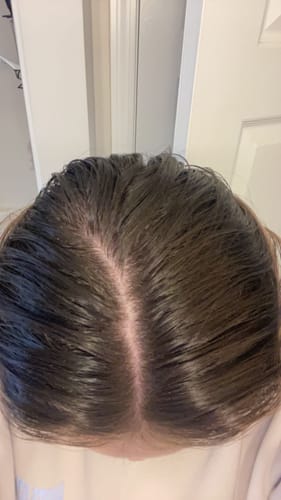 Customer photo review of Route Package Protection