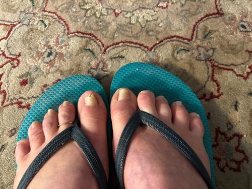 Customer photo review of Nano Defense Pro Serum