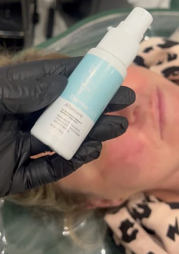 Customer photo review of AfterCare (30ml) - Discounted Bulk Purchase