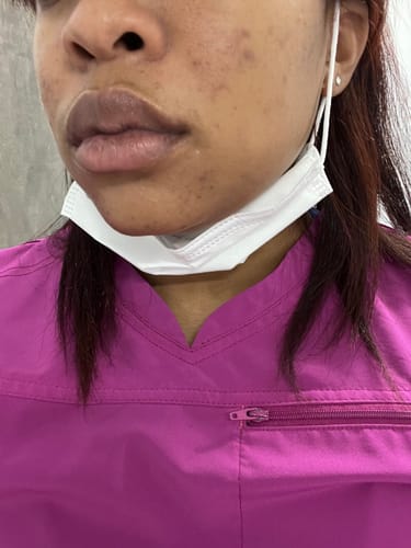 Customer photo review of Jolie’s Lip Kit