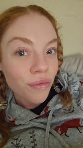 Customer photo review of La La Lips - Moisturizing Lip Balm