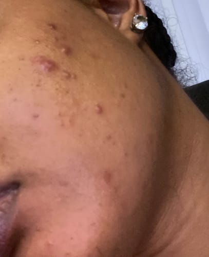 Customer photo review of LIMITED EDITION KIT Jolie’s Mini Full Body & Face Brightening Kit