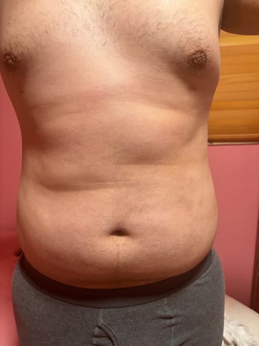 Customer photo review of Eris Lipo Cavitation Machine 9 in 1 Professional