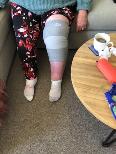 Customer photo review of Premium Bamboo Knee Sleeve (2X)