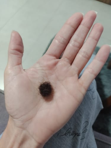 Customer photo review of Combo Anticaída - Shampoo, Acondicionador y Loción