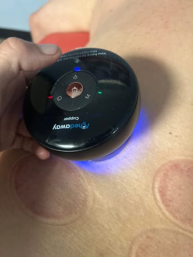 Customer photo review of Achedaway Cupper - The Smart Cupping Therapy Massager