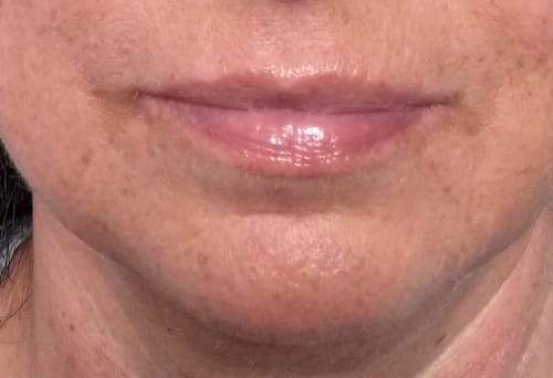 Customer photo review of ANTI-AGING LIP-CARE Lippenpflegestift mit Propolis, Hyaluron, Aloe Vera + Sheabutter