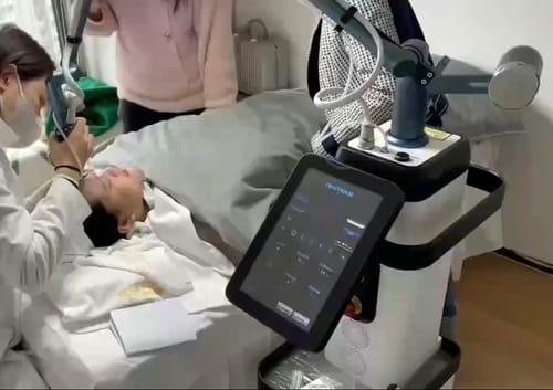 Customer photo review of ReDerma Fractional CO2 Laser with Upgraded RF Tube