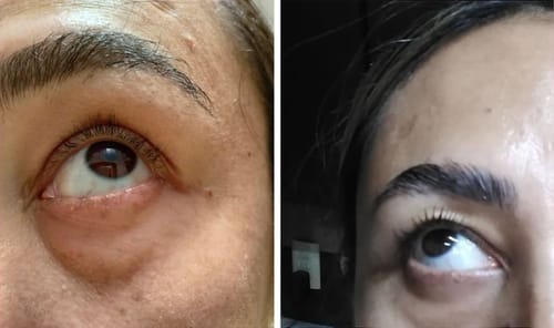 Customer photo review of Suero para pestañas y cejas