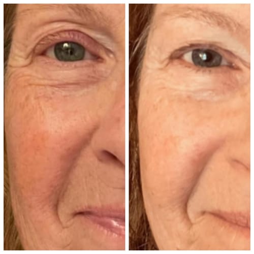 Customer photo review of Preserve & Restore