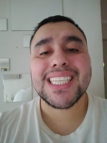 Customer photo review of Alineador Perdido