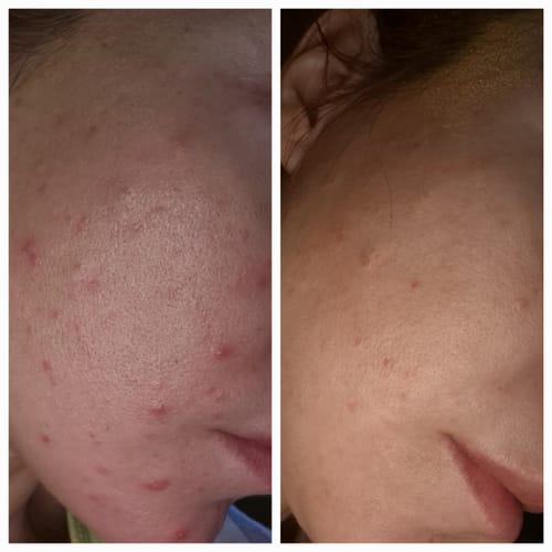 Customer photo review of Advanced Reset Program™