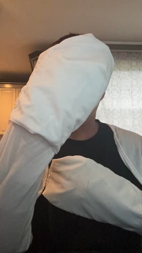 Customer photo review of Eczema Scratch Mitten