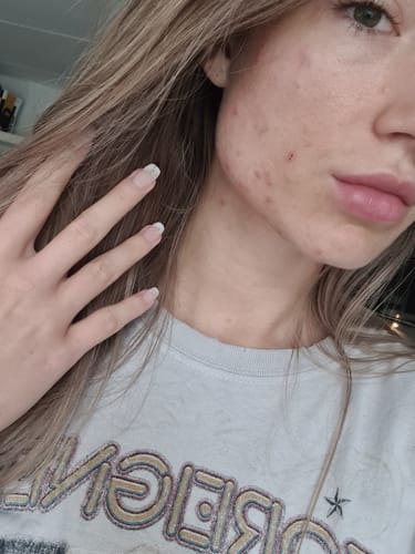 Customer photo review of Radiance Powder