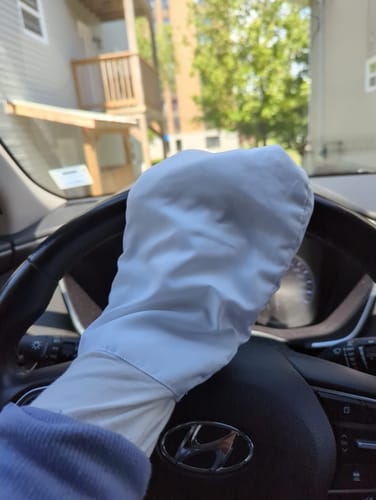 Customer photo review of Eczema Scratch Mitten