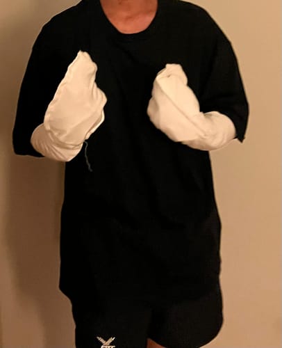 Customer photo review of Eczema Scratch Mitten