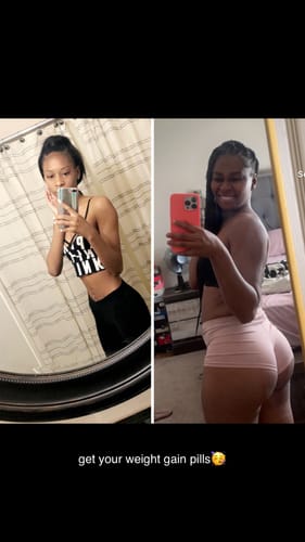 Mo R. review of GML-APETI(50 × 20 tablets) image 1 out of 1