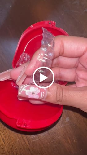 Customer video review of Premium Upper and Lower Retainer Set