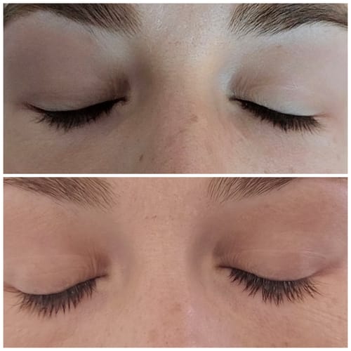 Customer photo review of LASH SERUM