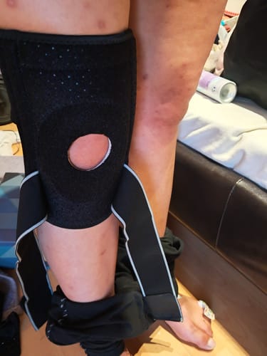 Customer photo review of Zselés Térdrögzítő