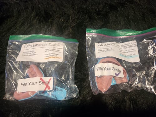 Customer photo review of File Your Smile (A Digital Copy of Your Impressions For Future Replacement Products)
