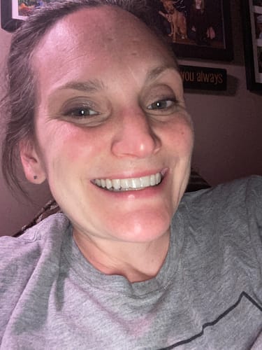 Customer photo review of Premium Upper Retainer