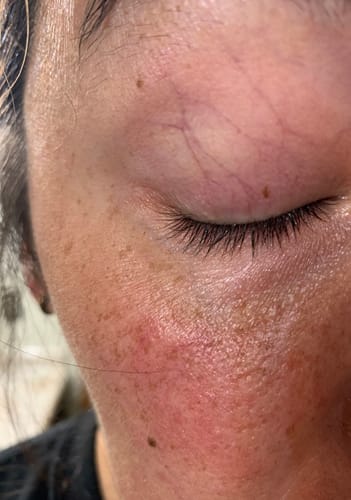 Customer photo review of Lash & Brow Enhancing Serum