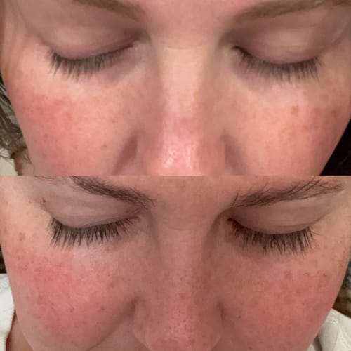 Customer photo review of ETERNAL EYELASH GROWTH SOLUTION