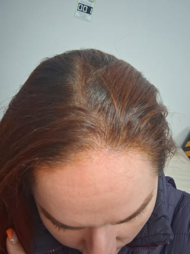 Reseña con foto de un cliente sobre Pack 2 Hennas Jamila BAQ Premium - Cobrizo Intenso y Duradero 🔥 👩🏼🦰