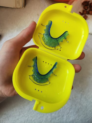 Customer photo review of Hawley Orthodontic Retainer, Buy One Get One 30% Off BOGO! Use code: HAWLEY30