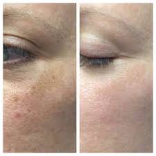 Customer photo review of DREAM CREAM - Instant Skin Reviver