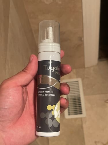 Customer photo review of 10% Tugain Foam Minoxidil Extra Strength Hair Regrowth for Men.