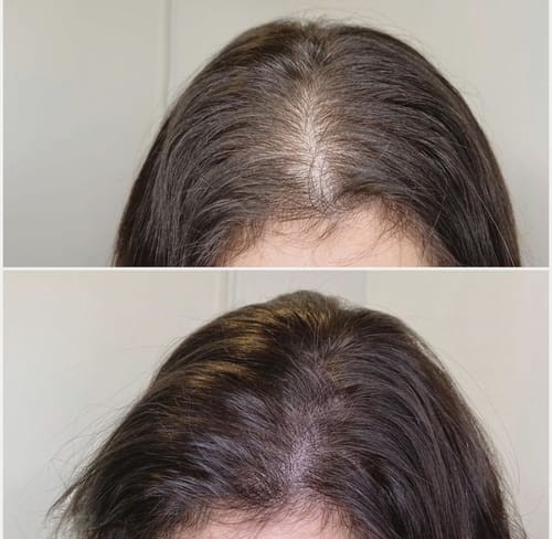 Customer photo review of Rosemary Scalp Treatment