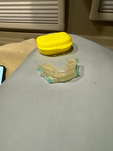 Customer photo review of Sleep Apnea Appliance, CLEAR RETAINER TRAYS, Includes Connectors $120 value