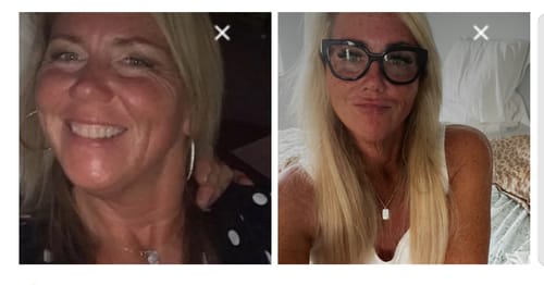 Customer photo review of Tirzepatide Weight Loss Program