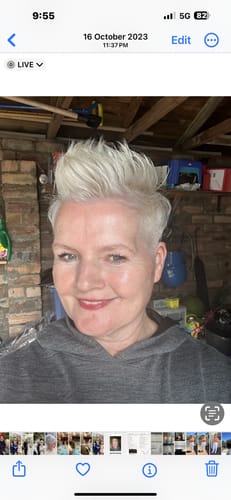 Customer photo review of SEA BUCKTHORN SERUM