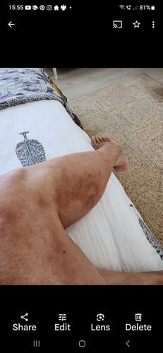 Customer photo review of Multi Strain Biotic