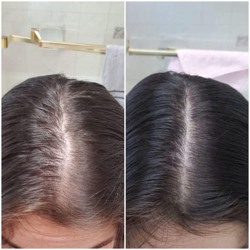 Customer photo review of Rosemary Scalp Treatment