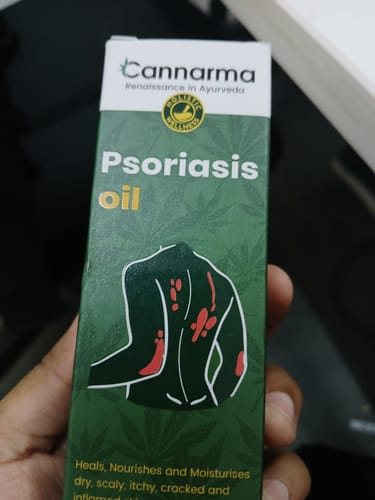 Customer photo review of Hemp Psoriasis Oil (100ml)