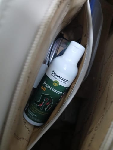 Customer photo review of Hemp Psoriasis Oil (100ml)