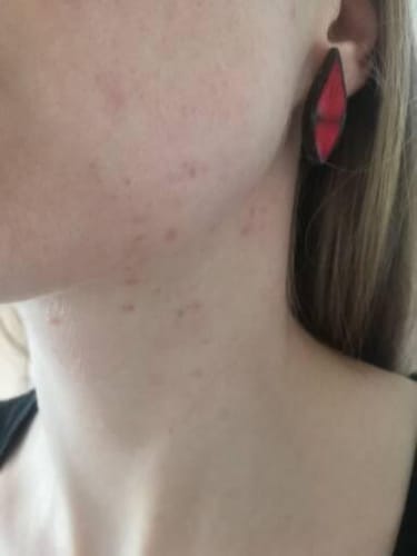 Customer photo review of Radiance Powder