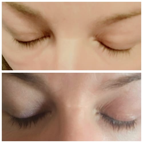 Customer photo review of LASH SERUM