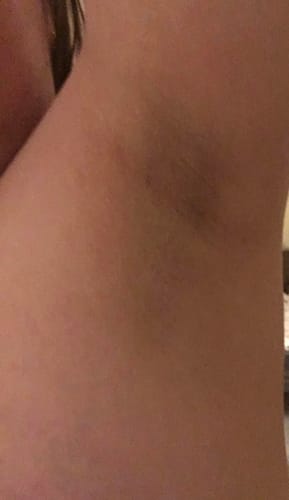 Customer photo review of Intimate Lightening Cream